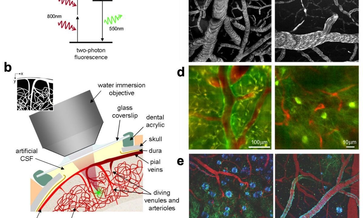 Illustrative photo: Two-photon microscopy of in vivo brain function (Wikimedia Commons, CC BY 2.0)